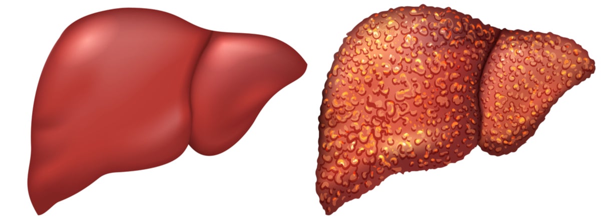 Язык Печени Фото — Mixyfotos.ru